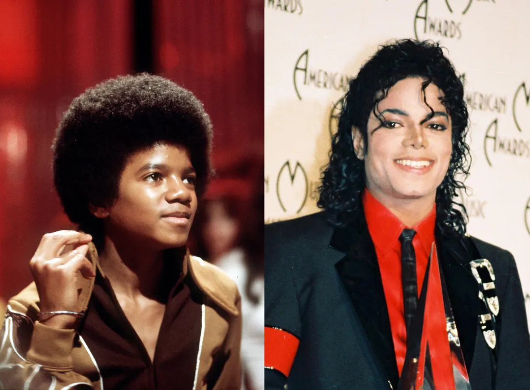 迈克尔杰克逊为什么变白(迈克尔杰克逊为什么把皮肤变白)